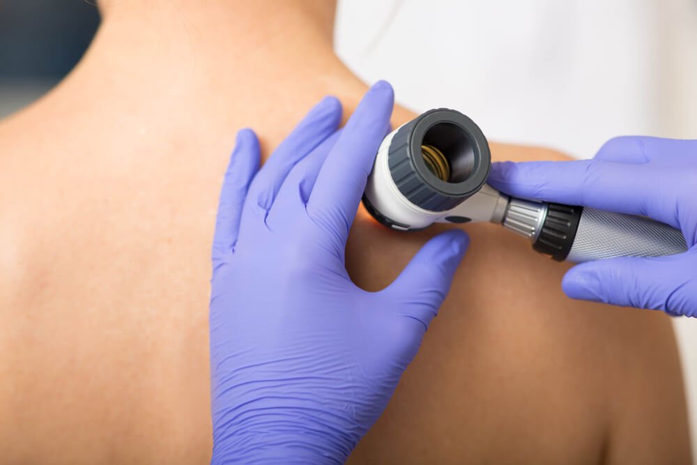 Mohs micrographic surgery for skin cancer at Malouf Dermatology.